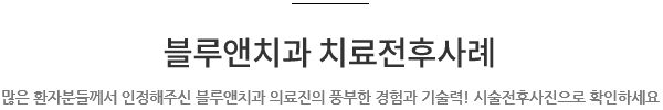 전후사례